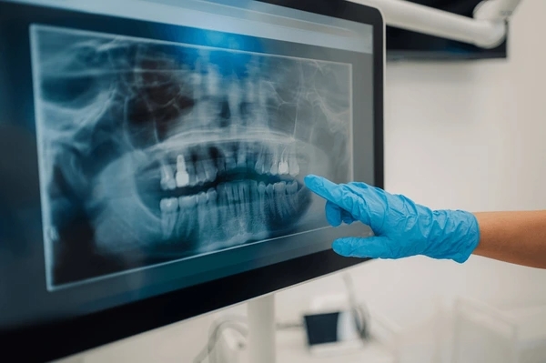 digital panoramic x-rays in midtown toronto on
