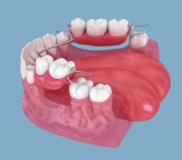 partial dentures in midtown toronto on