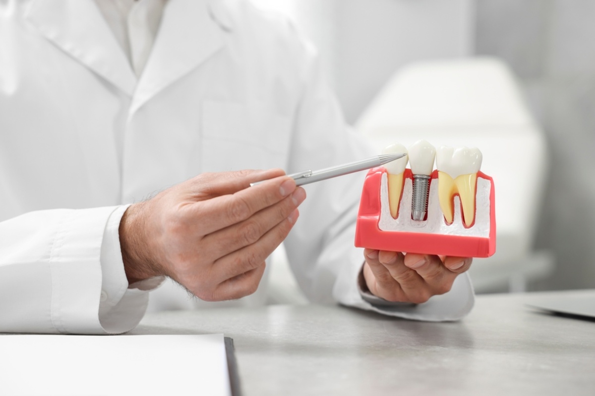 things that can cause dental implant failure