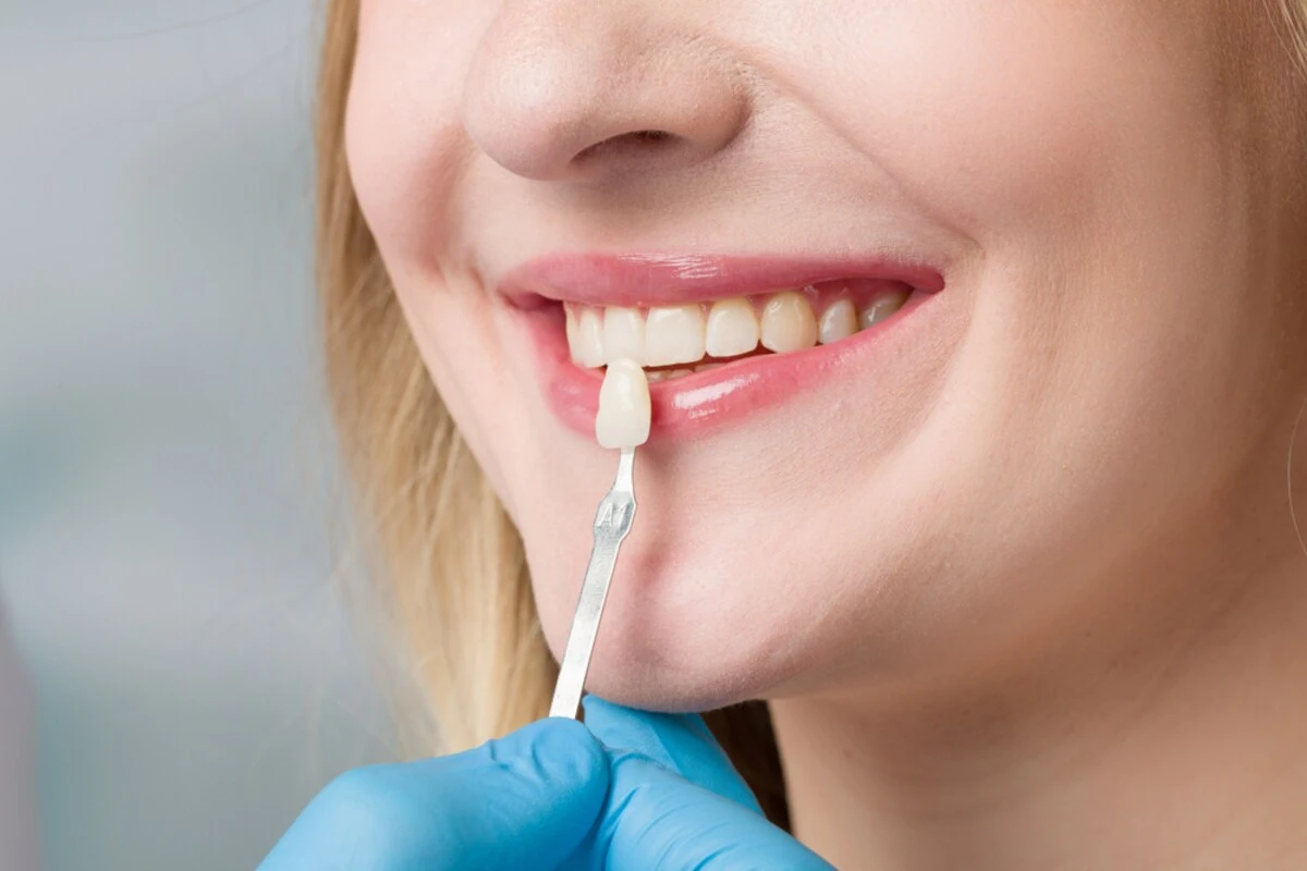 dental crowns when do you actually need one and how long do they last